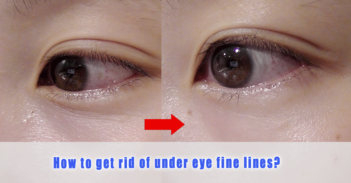 how-to-get-rid-of-under-eye-fine-lines-the-sesame-shop